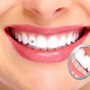 Tooth-jewellery_dental_arche-1